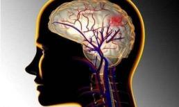 Nhồi máu não sắp đến, nhà tiên tri giấc ngủ? Nhắc nhở: 5 dấu hiệu khi ngủ, hay cảnh báo trước khi bị nhồi máu não