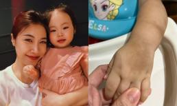 Pha Lê xót xa tiết lộ tình trạng của con gái: Không rõ tình trạng bệnh, bôi thuốc vẫn chưa khỏi