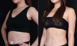 Bật mí phương pháp giảm béo thần tốc an toàn hiệu quả chỉ trong 60 phút