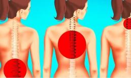 Các bài tập kéo giãn cơ trong một phút giúp bạn giảm đau lưng ngay lập tức 