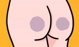 Có 'hai đám đen' sau mông, chúng đã hình thành như thế nào? 5 yếu tố chính bạn cần biết! 