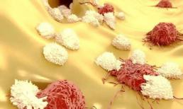 Mất bao lâu để chuyển từ viêm sang ung thư? Nhắc nhở: Có 3 loại viêm này nên chữa càng sớm càng tốt!