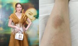 Sau cú ngã bất ngờ tại sự kiện lớn, Lý Nhã Kỳ gây lo lắng khi cập nhật tình trạng hiện tại 