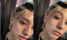 Nam ca sĩ Hàn - Holland bị đánh giữa đường vì công khai là người đồng tính