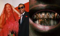 Cầu hôn kiểu bạn trai Rihanna: Gắn dòng chữ 'Cưới anh nhé' lên răng, cách cô nàng đáp trả cũng 'độc' không kém 