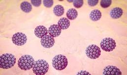 Người phụ nữ 60 tuổi nhiễm virus HPV không để ý mà chết vì ung thư cổ tử cung. Bác sĩ: 'Cần chú ý 2 triệu chứng chính' 