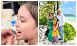 Lý Bình hết lòng thương con riêng của vợ, chỉ một chi tiết nhổ răng càng làm dân tình xuýt xoa