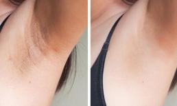 Cách giảm mờ vùng thâm dưới cánh tay để tự tin đi biển mùa hè với thứ gia vị có sẵn trong nhà bếp