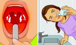 Hơn 10 cách tự nhiên để loại bỏ các bệnh cảm cúm và nhiễm trùng đường hô hấp thông thường