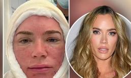 Nữ diễn viên nổi tiếng Mỹ bị chỉ trích khi khoe thẩm mỹ kéo căng da cổ