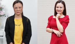 Tìm ra phương pháp trị nám an toàn, hiệu quả bậc nhất hiện nay mang tên công nghệ Max Cell