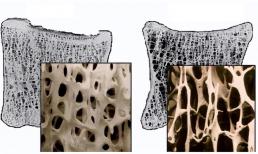 Tại sao người Nhật hiếm khi bị loãng xương? Sau khi đọc 4 yếu tố này, bạn có thể hiểu