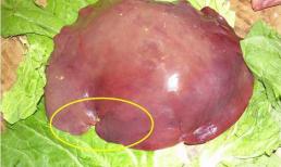 Đừng mua gan lợn có 4 đặc điểm này, nhất là loại thứ nhất chứa 100% ký sinh trùng nhé! 