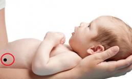 Nốt ruồi ở vị trí này, trẻ sớm mang mệnh quý nhân, mang lại tài lộc và giàu sang