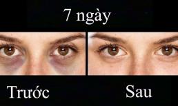 Chỉ cần 7 ngày kiên trì với những phương pháp dưới đây, quầng thâm dưới mắt bạn sẽ hoàn toàn biến mất