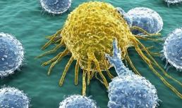 Ung thư có ba 'nỗi sợ” này, nếu làm được thì tế bào ung thư sẽ khó 'đối phó' với bạn