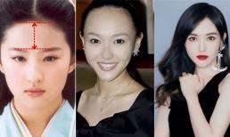 Làm thế nào để đường chân tóc không ảnh hưởng đến ngoại hình? Đọc xong bạn sẽ biết! 