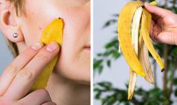 Vỏ chuối và 10 thứ làm cho làn da của bạn đẹp hơn ngay lập tức