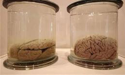 Các nhà khoa học Anh đã phát hiện ra một 'bộ não' vẫn còn 'hoạt động' cách đây 2.600 năm!