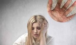 Tại sao một số người luôn rụng tóc, rất nhiều cùng một lúc? Không ngờ, thủ phạm hóa ra lại là 'nó' 