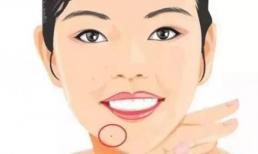 Năm nốt ruồi tài lộc trên cơ thể sẽ trúng quý nhân, dễ được lãnh đạo đánh giá cao, có thể kiếm được nhiều tiền