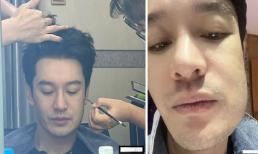 Huỳnh Hiểu Minh khiến fan lo lắng vì khuôn mặt biến dạng, sưng phù giữa lúc dính nghi vấn hẹn hò hot girl sau ly hôn