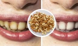 5 cách làm trắng răng đơn giản, an toàn ngay tại nhà 