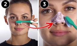 4 cách để loại bỏ mụn đầu đen trên mũi của bạn