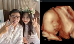 BTV Hà My đăng ảnh siêu âm con, chia sẻ mặt bé không giống mẹ chút nào 