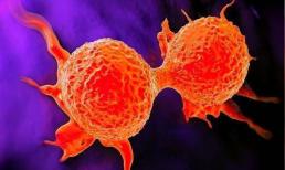 Không phân biệt giới tính, nếu ở cổ có 3 “tín hiệu” thì có thể là báo hiệu cho tế bào ung thư “hoạt động”