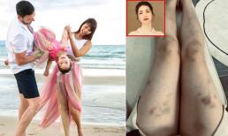 Sao Việt 28/6: Full ảnh tiệc sinh nhật hoành tráng của con gái Hà Anh; Chân Hòa Minzy bầm dập, thâm tím, chuyện gì đây?
