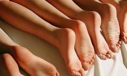 Bạn có thể biết một người phụ nữ có khỏe mạnh hay không bằng cách nhìn vào bàn chân của cô ấy? Bàn chân của bạn có 4 đặc điểm này không?