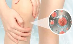 Chúng là “sát thủ” axit uric, mỗi ngày ăn một ít, axit uric sẽ chạy nhanh và bệnh gút sẽ không 'tấn công'