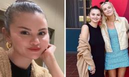 Selena Gomez đẹp miễn chê khi chụp cận cảnh gương mặt nhưng ảnh chụp toàn thân lại bị mất điểm vì điều này