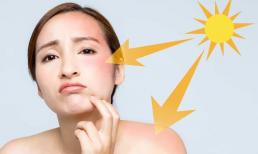 Các cô gái đừng bỏ lỡ nhé! Đây là 5 loại trái cây và rau quả rất tốt để giảm bắt nắng