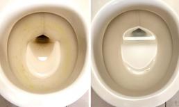 4 mẹo đơn giản giúp loại bỏ mảng bám vàng bẩn khó chịu trong bồn cầu