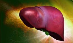 4 dấu hiệu này xuất hiện vào “buổi sáng” thì 9/10 là dấu hiệu của bệnh xơ gan, nếu bạn không có dấu hiệu nào, xin chúc mừng