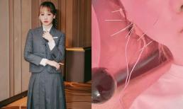 Hari Won tiếp tục hé lộ trình trạng sức khỏe gây lo lắng đến mức mặt toàn kim châm cứu