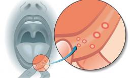 Ung thư trong cơ thể, tiên tri từ miệng? Nếu có 3 dấu hiệu ở miệng thì đó có thể là dấu hiệu cho thấy bệnh ung thư sắp đến