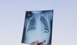 Từ tế bào ung thư thành ung thư chỉ cần 5 bước, nếu bạn can thiệp ngay từ bước đầu tiên, đừng hoảng sợ