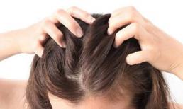 Đau da đầu thường xuyên cho thấy những thay đổi bệnh lý trong cơ thể, hoặc 5 căn bệnh này, bạn đừng bỏ qua nhé!