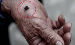 Ung thư trong cơ thể, nhà tiên tri về da! '4 thay đổi' của làn da, hay còn gọi là 'thẻ vàng cảnh báo' ung thư