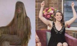 Cô là người phụ nữ có bộ lông dài nhất thế giới, khi loại bỏ lông toàn thân, vẻ đẹp tuyệt vời đã lộ ra