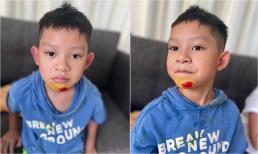 Cậu út nhà Lý Hải thêm bề dày tai nạn vì nghịch ngợm: Hết ngã gãy tay, gãy xương đòn, mới nhất là ngã téc cằm, mặt mày bầm dập