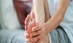 Axit uric: Uống 5 loại đồ uống này để kiểm soát axit uric cao trong máu