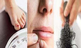 Các triệu chứng của PCOS: Đừng bỏ qua sự thay đổi này của cơ thể, đây là triệu chứng ban đầu của vấn đề PCOS!