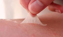 Làm thế nào để khắc phục làn da bị cháy nắng trên khuôn mặt? 7 cách để khắc phục nhanh chóng