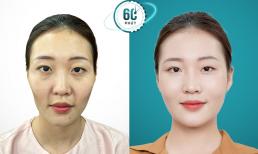 Biotech Clinic - Địa điểm lưu giữ thanh xuân tươi trẻ rạng ngời