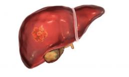 Người đàn ông chỉ uống nước mỗi sáng suốt 22 năm qua đời vì ung thư. Chuyên gia: 'Đừng uống cốc nước này dù bạn có tiết kiệm được tiền!'