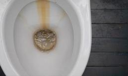 Cách loại bỏ cặn dính trong bồn cầu nhờ hai thứ rẻ tiền, có sẵn trong nhà bếp 